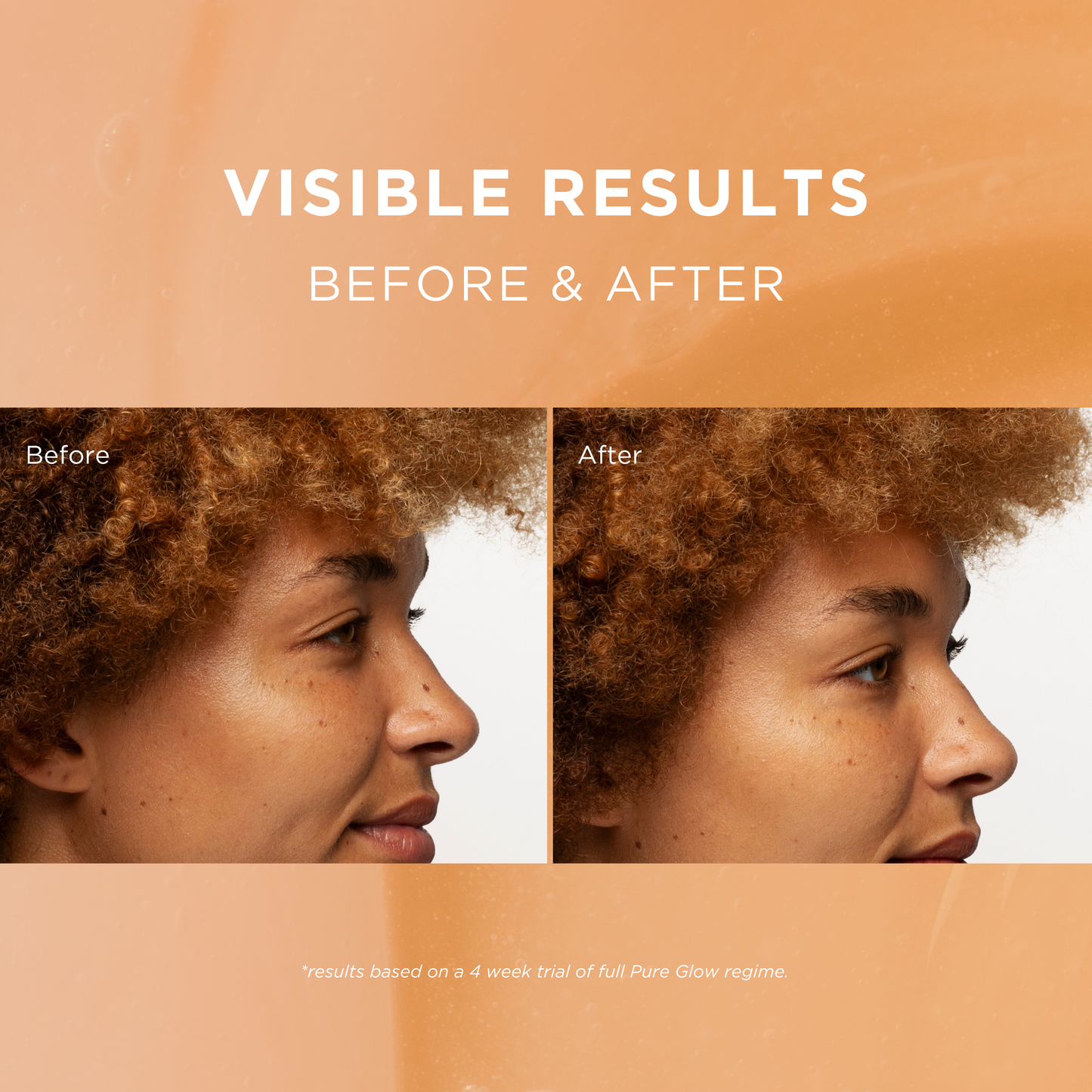 Pure Glow Brightening Set - Fade Out Skincare