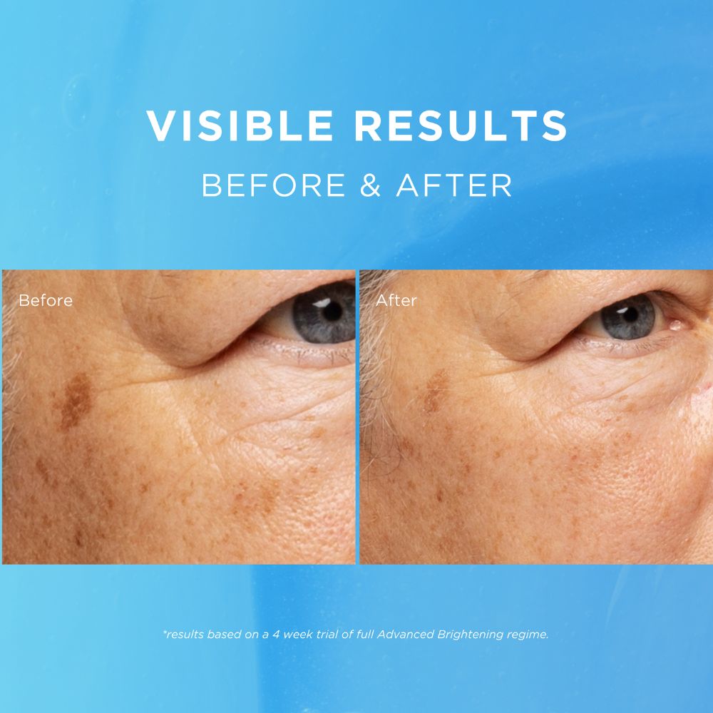 Advanced Brightening Day Cream SPF20 - Fade Out Skincare