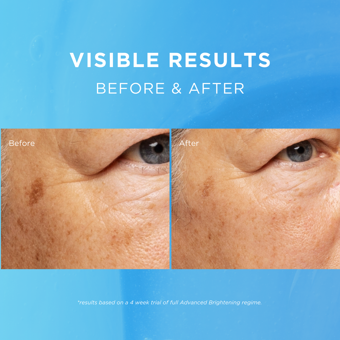 Advanced Brightening Day & Night Cream Duo - Fade Out Skincare