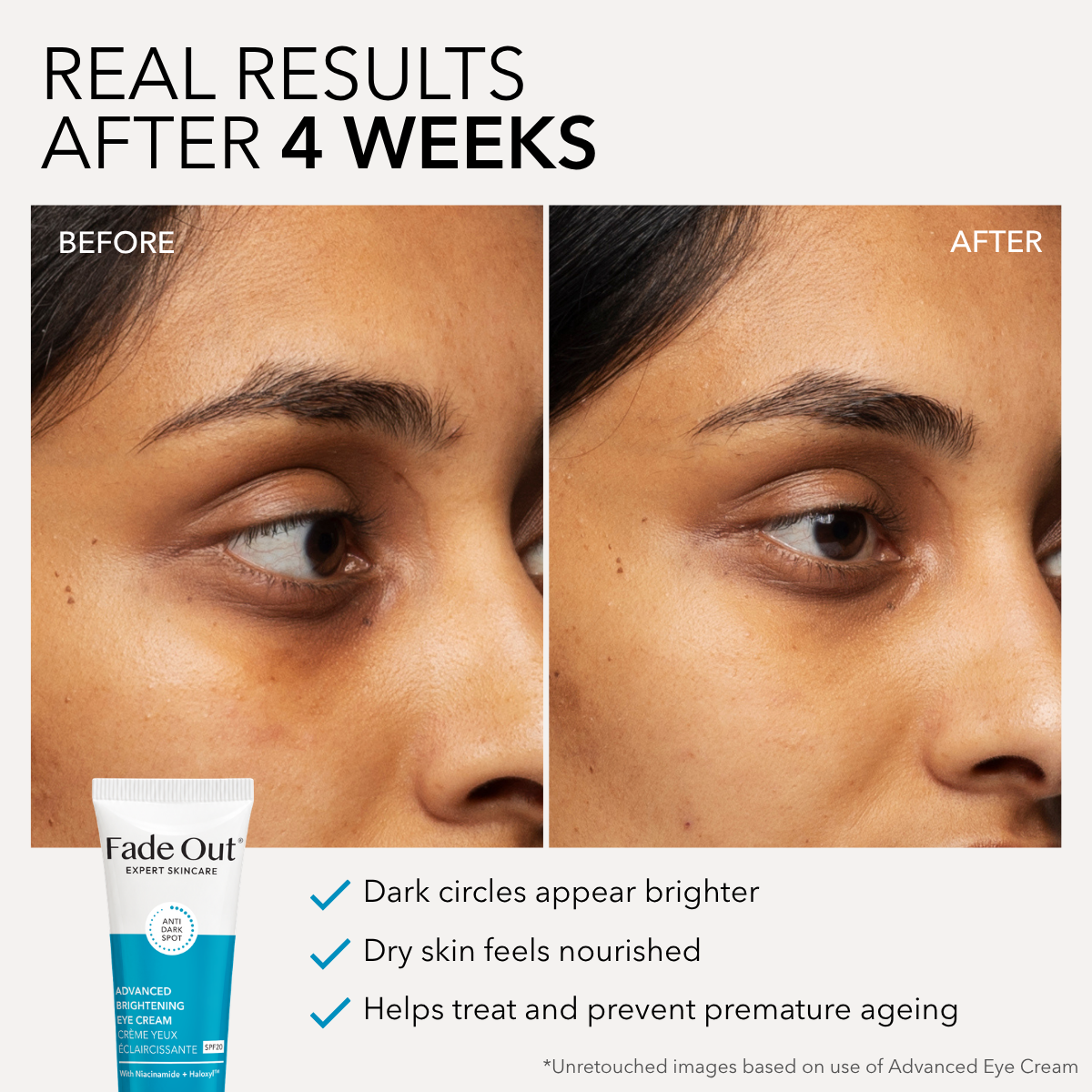 Advanced Brightening Eye Cream SPF20
