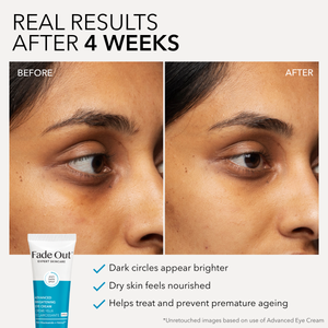 Advanced Brightening Eye Cream SPF20
