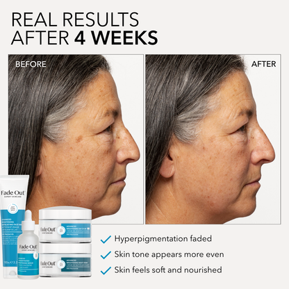 Advanced Concentrated Brightening Serum