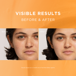 Pure Glow Concentrated Brightening Serum